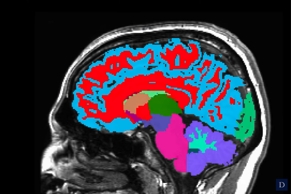 Colorful brain scan image on black background