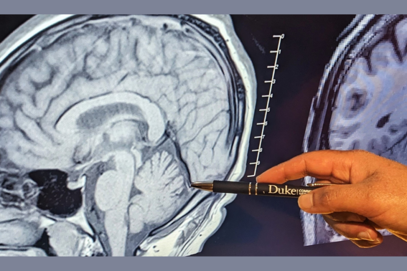 Hand holding a pen pointing to brain image on computer screen