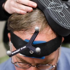 Person performing magnetic brain stimulation