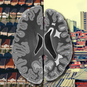 Black and white brain image overlaid on two different neighborhoods