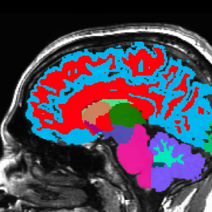 Colorful brain scan image on black background